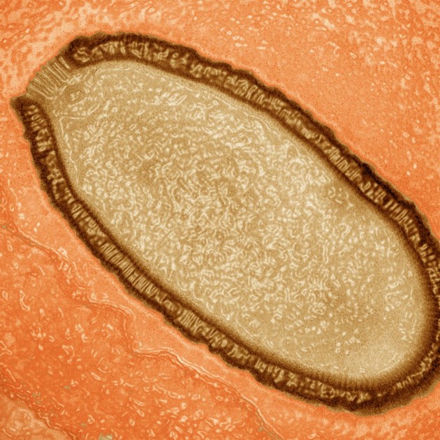 Una imagen de una ameba infectada por el 'pithovirus'. Parte del patógeno puede verse arriba a la izquierda como una estructura de bandas paralelas. / J.Bartoli, C. Abergel 